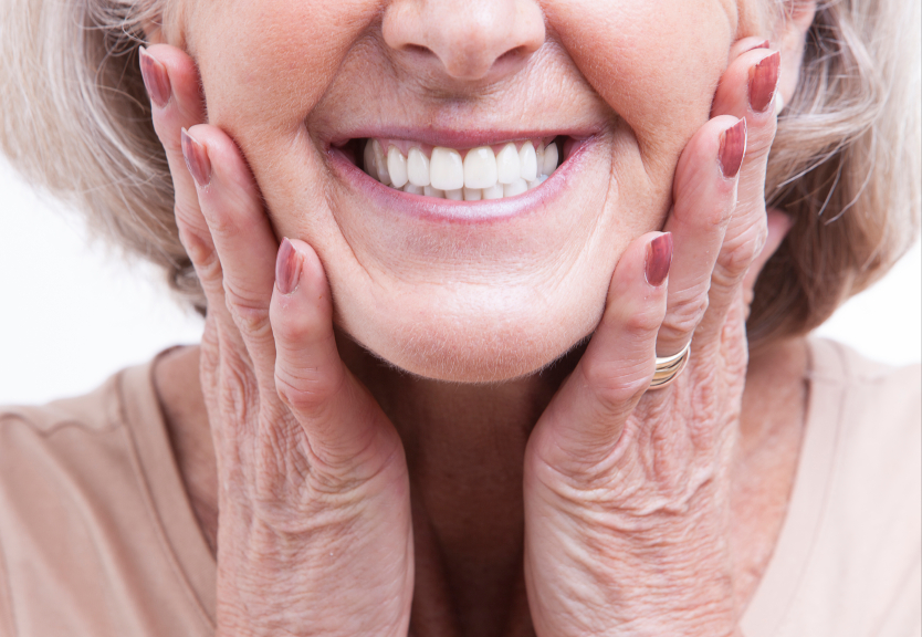 A close up of woman’s smile with dentures from Hunter Dental Care in Portland, OR